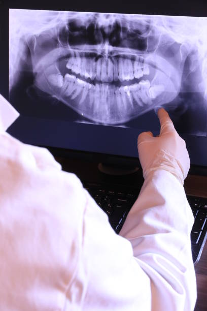 Best Emergency Treatment for Oral Infections in Mound, MN